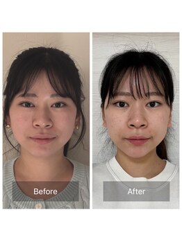 かぐや(salon)/ビフォーアフターのお写真