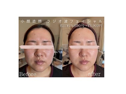 ノイ(Noi)の写真