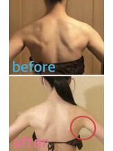 メディカルエステサロン ローズ 鯖江店(ROSE)/ 気になる二の腕もスッキリ！