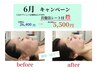 30名様限定★【人気No.1♪】 フルオーダーメイド高濃度気体水素フェイシャル