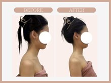 スリムライン 弘前店(The Slim Line)/before→after