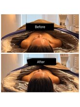 女神デトックス 西宮店(女神DETOX)/背中のマッサージで肩が！？