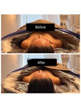 女神デトックス 西宮店(女神DETOX)/背中のマッサージで肩が!?