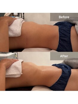 ルネアススパ 南青山(Lune’as Spa)/《WINBACK》お腹/内臓活性