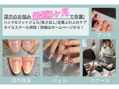 レジューネイル(Rejyu Nail)の写真