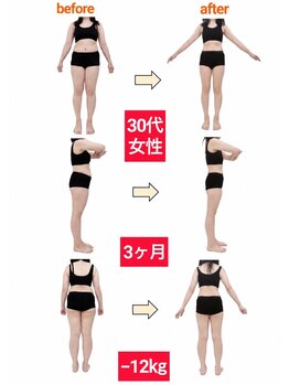 リボディ(REBODY)の写真/《ダイエット》憧れ服も着こなせるペタンコ腹に！【骨盤矯正+引き締め機器エムドライブ+ダイエット微細針】