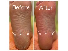 ネイルミュージアム(Nail Museum)の雰囲気（フットケア理論所持者のみ。最強フットケア。持込画像もOK！）