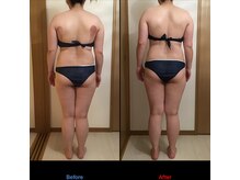 サロン シエラ/施術5回　30代