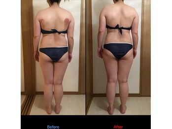 サロン シエラ/施術5回　30代