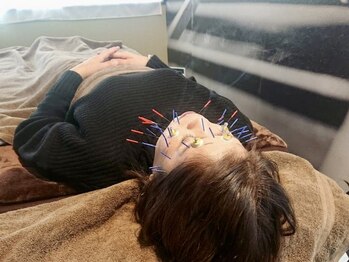 アパト鍼灸院(APaT)/鍼灸で美肌・たるみケア