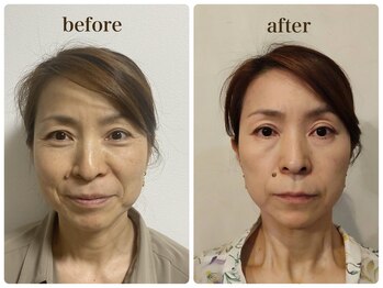 かぐや(salon)/ビフォーアフターのお写真