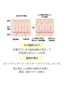ボヌール 久留米(Bonheur)/痩身