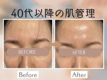 ル シェノン(Le Chainon)の雰囲気（40代以降のエイジングケアならお任せ下さい！）