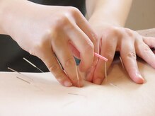 健康堂 荏原町院/鍼灸もお任せください♪