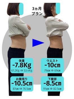 Noa接骨院 はりきゅう院/友達から痩せたね。と言われた☆
