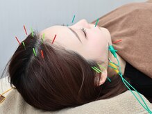 いおり鍼灸接骨院の雰囲気（美容鍼/小顔/鍼灸/ヘッドスパ/シミ/たるみ/むくみ）