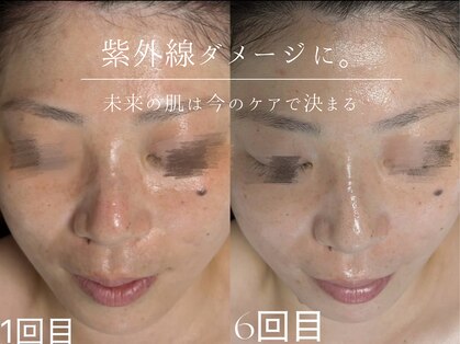 ウィハナ(wehana)の写真