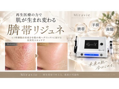 ミラヴィエ(Miravie)の写真
