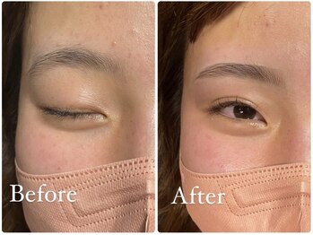 ダウニー(Downy)/20代/女性/保育士