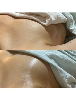 ララルアナ(Lara luana)/バストの土台を整える