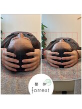 フォレスト(forrest)/頭蓋骨調整