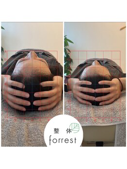 フォレスト(forrest)/頭蓋骨調整