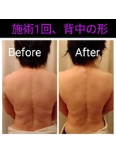 フォンダン(fondant)/