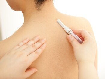 レゾン 京橋店/【ブライダル】背中シェービング