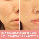 モアビューティーエステ 本通り店(MORE BEAUTY ESTHE)