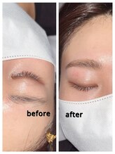 カラ(calla)/ハリウッドブロウリフト