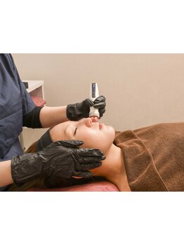 小顔になりたい