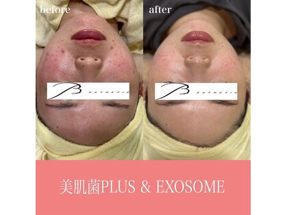 ビー エステティック(B ESTETIC)の写真
