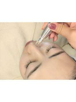 毛穴ケアをしたい