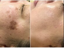 グレースフル 天文館店/お客様ビフォーアフター