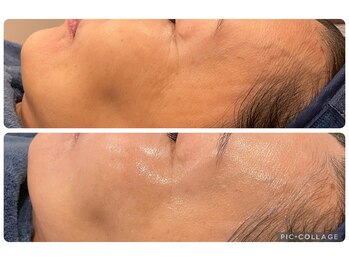 フリーシャ いせさき店(freesha)/【ゆうみ】韓国VVIP向け施術