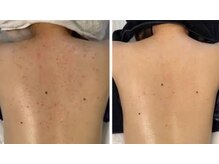 スリリアン 銀座/★お客さまビフォーアフター★