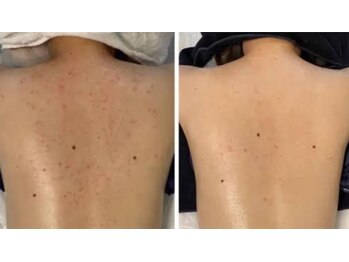 スリリアン 銀座/★お客さまビフォーアフター★