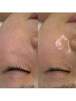 ウィンウィン 新山口店(Win Win)/before→after