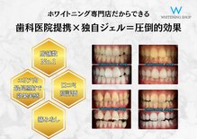 ホワイトニングショップ 飯塚店