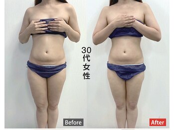 ワイズ(Y's)/お腹周り