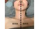 レリューム 宝塚(relume)の写真