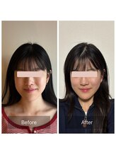 かぐや(salon)/ビフォーアフターのお写真