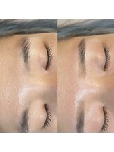 十美/【美眉♪】before　after