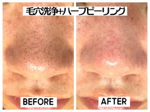 ハオン(HAON)の雰囲気（毛穴丸ごと洗浄＆徹底吸引+ハーブピーリングで感動の黒ずみ撲滅!）