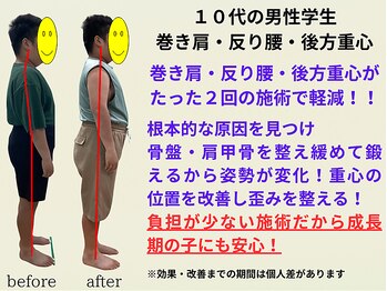 とりまる整体院 アイワイ(iy)/１０代学生さんの姿勢改善！