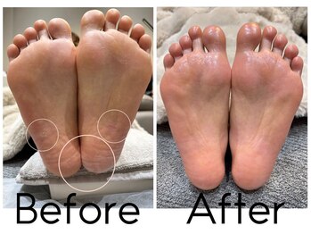 【グルニエ式】癒しのフットスパ