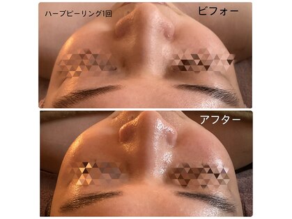 ミヤビ(MIYABI)の写真