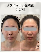 ネイルアンドアンチエイジングドゥシール(Docile)/30代女性｜小顔・たるみ改善