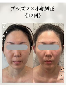 ネイルアンドアンチエイジングドゥシール(Docile)/30代女性｜小顔・たるみ改善