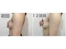 トータルビューティーサロン ナーズ(NAZ)/光バストアップ